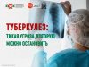 Туберкулез Тихая угроза, которую можно остановить