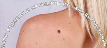 Могут ли родинки и полипы переродиться в меланому?